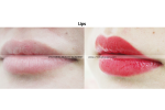 (10) 21c korea feathering micropigmentation, lips